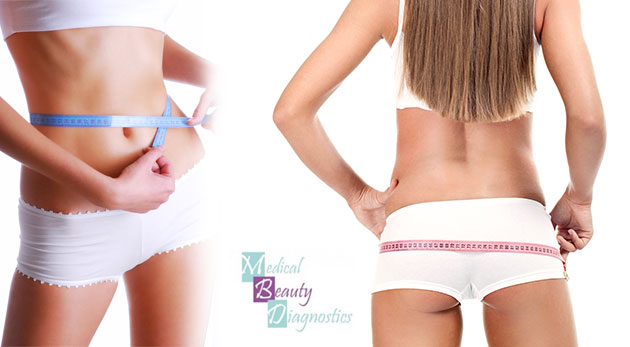 Medicínska laserová liposukcia a extra BONUS