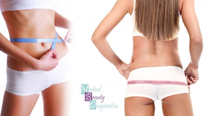 Medicínska laserová liposukcia a extra BONUS