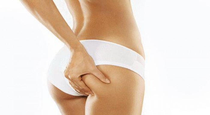 Magic Wrap - telový detoxikačnochudnúci zábal s ok