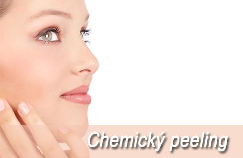 Nechajte svoju pleť zažiariť! Chemický peeling-nei