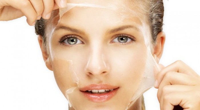 Nová rozžiarená pleť pomocou chemického peelingu