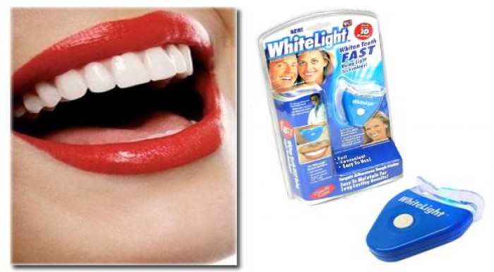 Využite zľavu 54% a nechatje svoj úsmev vyniknúť -