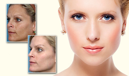 Najúspešnejšia metóda v oblasti estetickej medicín