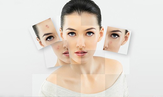 HĹBKOVÉ ČISTENIE pleti s BIOSTIMULAČNÝM LASEROM. 