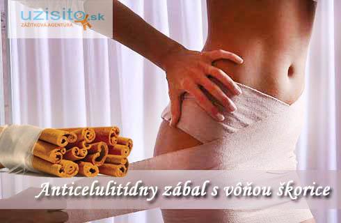 Cíťte sa skvele a doprajte si anticelutitídny zába