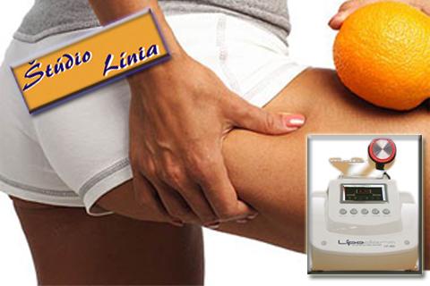 Najmodernejší prístroj na trhu Vám zabezpečí ploch