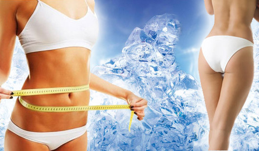 Kryolipolýza – trvalá redukcia podkožného tuku