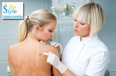 Kontrola znamienok dermatoskopom + odstraňovanie v
