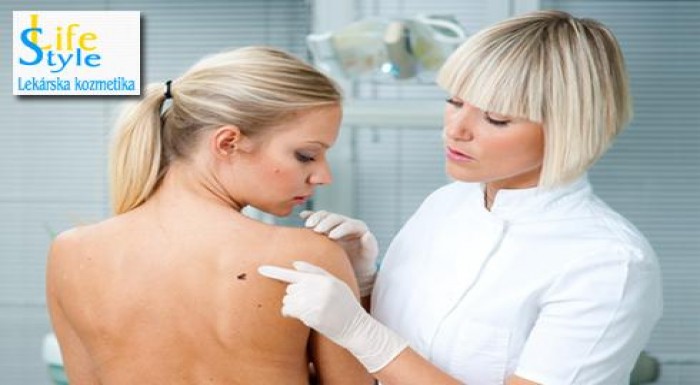 Kontrola znamienok dermatoskopom + odstraňovanie v
