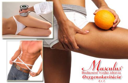 Oxygenokavitácia (rozbíjač tukov) 4 v 1! Vyskúšajt