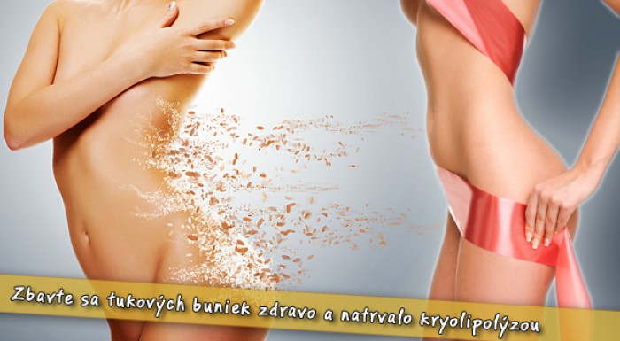 Zmrazte svoje tukové bunky - raz a navždy! Kryolipolíza za skvelú cenu.