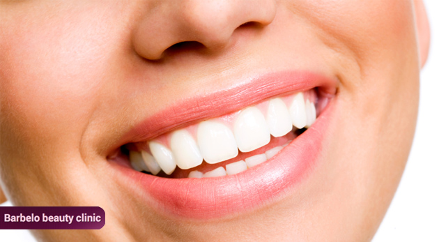 Laserové vybielenie zubov