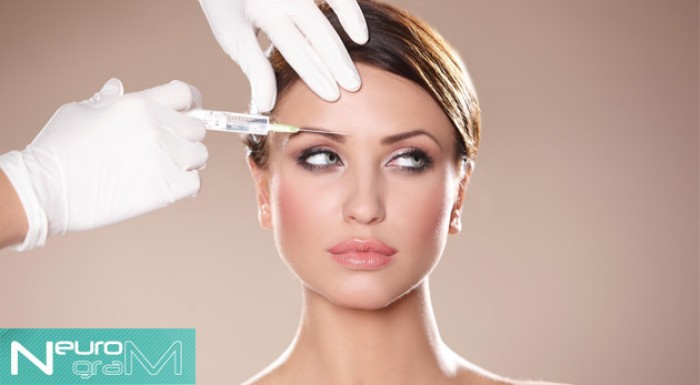 Lekárska aplikácia botulotoxínu