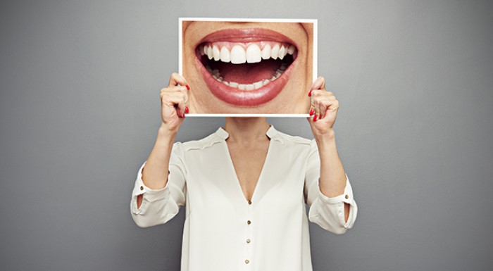 Profesionálne vybielenie zubov 