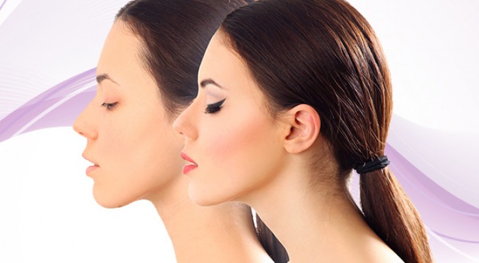 Ošetrenie plazmovým tokom a kyselinou hyalurónovou