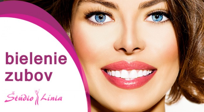 Bezperoxidové bielenie zubov 