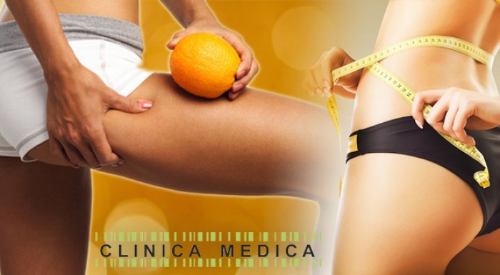 Prvá certifikovaná metóda termokryolipolýzy v Bratislave.