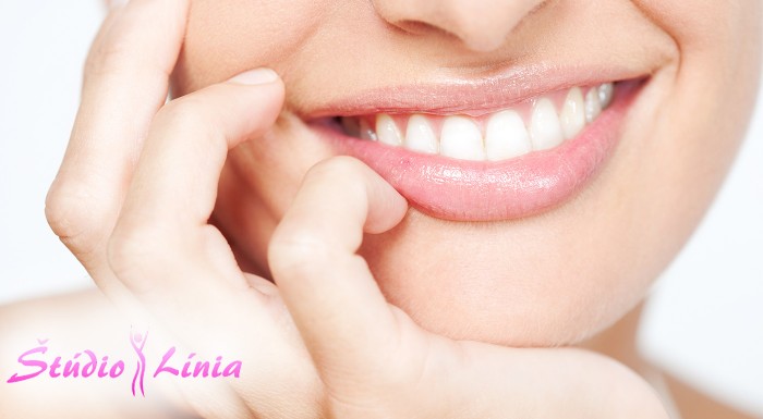 Šetrné bielenie zubov v Bratislave