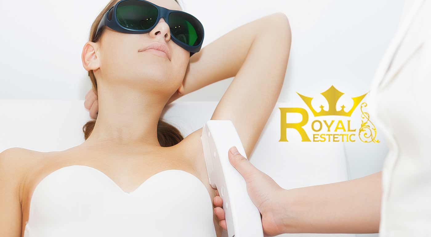 SHR laserová epilácia v Royal Estetic Bellande