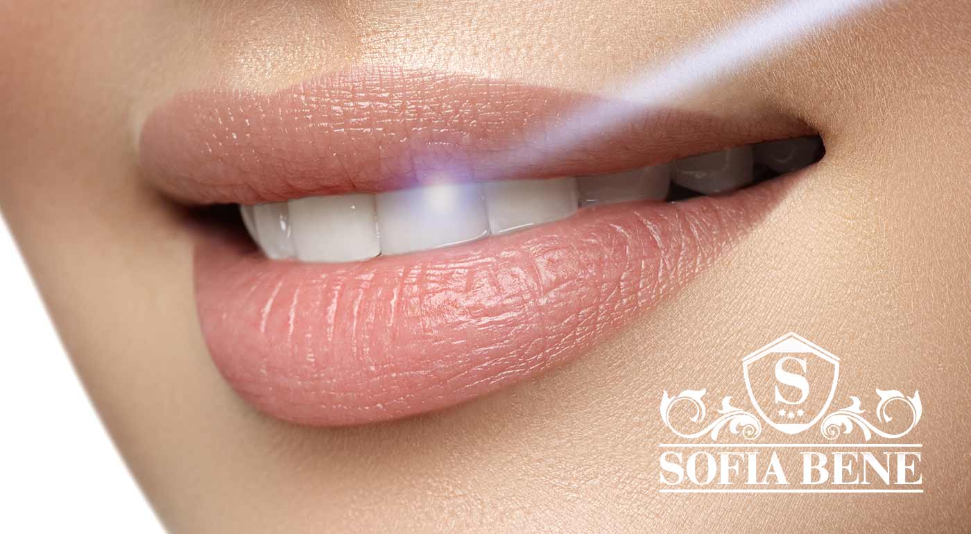 Laserové bielenie zubov