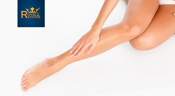 Laserová epilácia v salóne Royal Esthetic