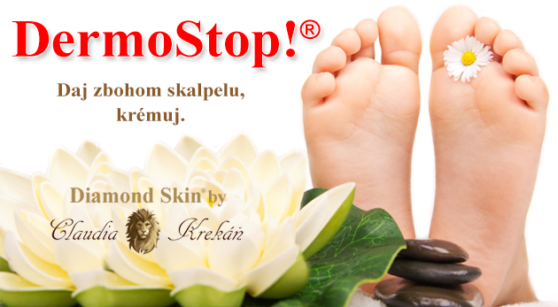 Krásna pokožka nahej nôžky! DermoStop!® - krém na odstránenie zhrubnutej kože na chodidlách.