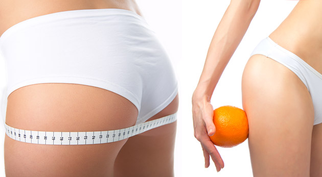 Prístrojová lymfodrenáž - vyformujte, spevnite a zbavte svoje telo celulitídy