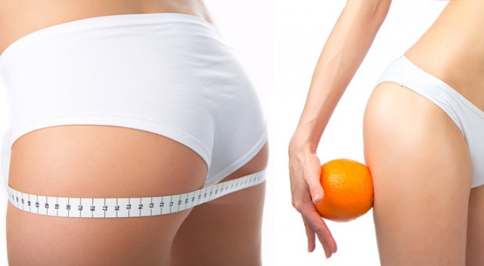 Prístrojová lymfodrenáž - vyformujte, spevnite a zbavte svoje telo celulitídy