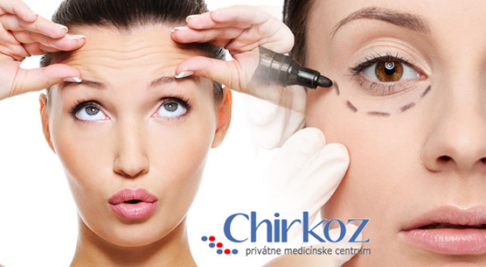 Plastická operácia horných alebo dolných viečok. 