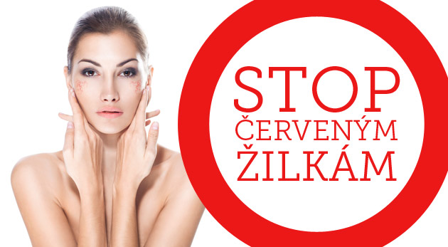 Ukončite svoje trápenie s červenými žilkami na tvári alebo tele - odstráňte ich vysokoúčinným prístrojom Anife 3D v Štúdiu KryoLine.