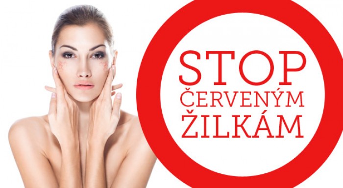 Ukončite svoje trápenie s červenými žilkami na tvári alebo tele - odstráňte ich vysokoúčinným prístrojom Anife 3D v Štúdiu KryoLine.