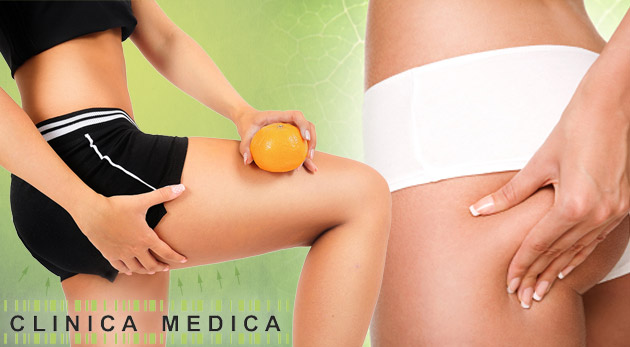 Úbytok tuku 25 - 30% po jedinom ošetrení certifikovanou termokryolipolýzou v Bratislave.