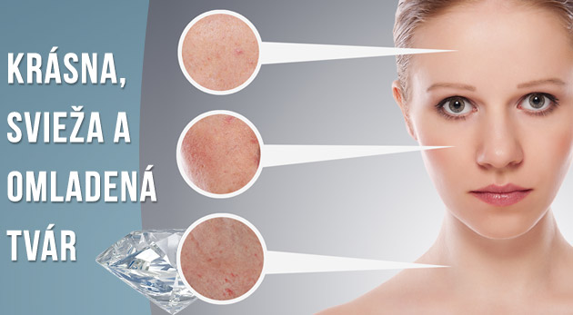 Diamantová mikrodermabrázia.