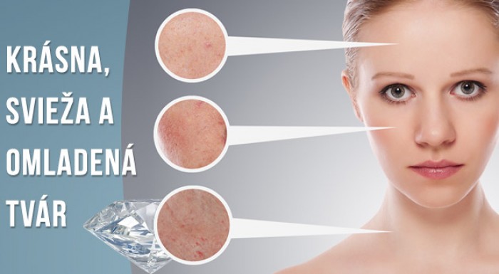 Diamantová mikrodermabrázia.