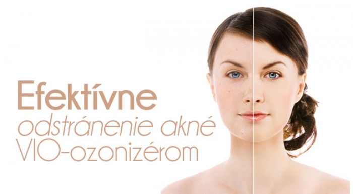 Účinné ošetrenie aknóznej pleti