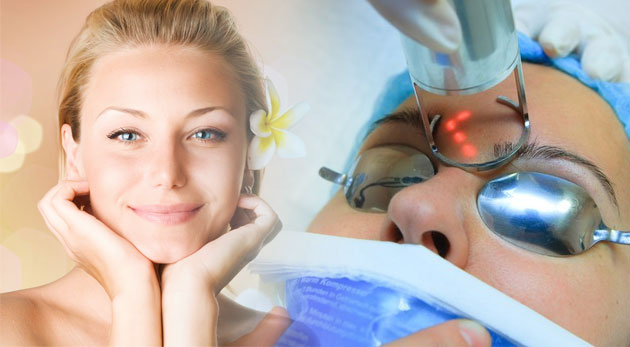 Frakčný resurfacing CO2