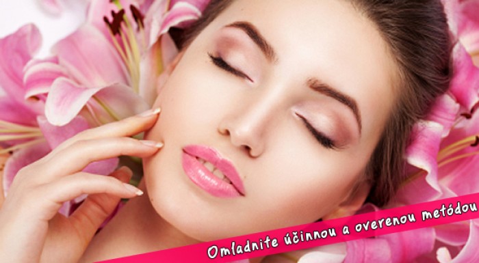 Kolagénová indukčná terapia - mezoterapia dermarollerom.