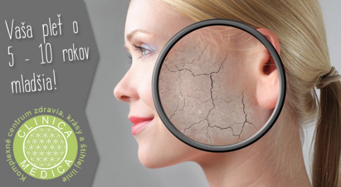 Omladnite rádiofrekvenciou - výsledky zaručené!