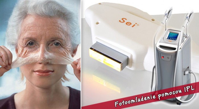 Fotoomladenie pomocou IPL