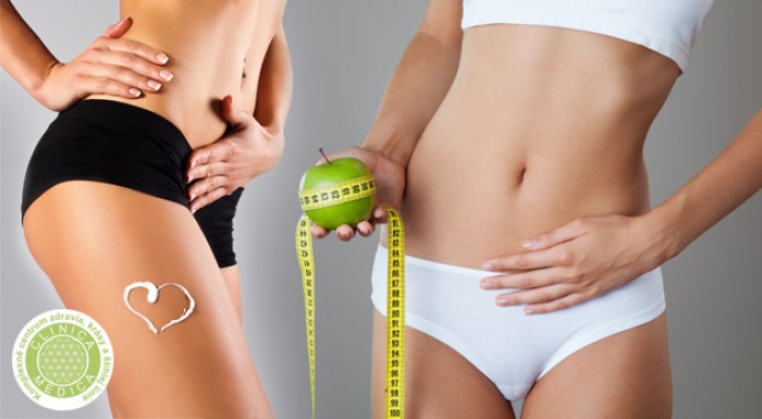 Lekárska kryolipolýza 