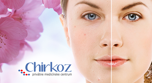 Medicínska frakčná mikroihličková rádiofrekvencia