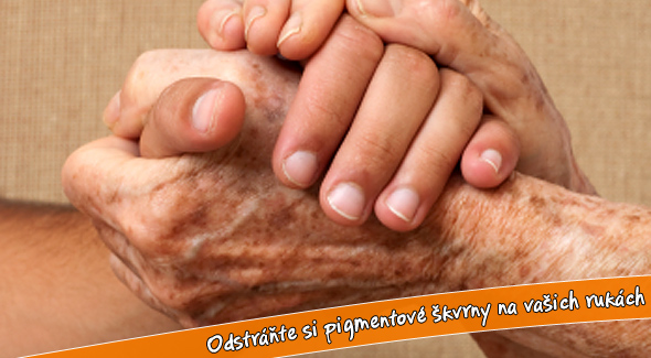 Odstránenia pigmentových škvŕn na rukách.