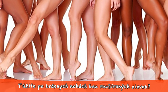 Odstránenie žiliek na nohách