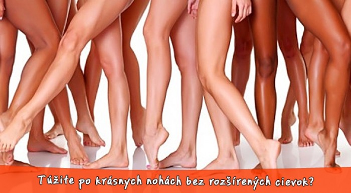 Odstránenie žiliek na nohách