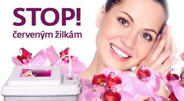 Odstránenie červených žiliek prístrojom Anife 3D