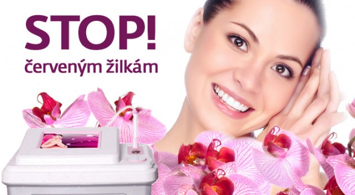 Odstránenie červených žiliek prístrojom Anife 3D