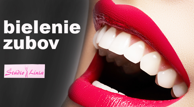 Bielenie zubov bez peroxidu