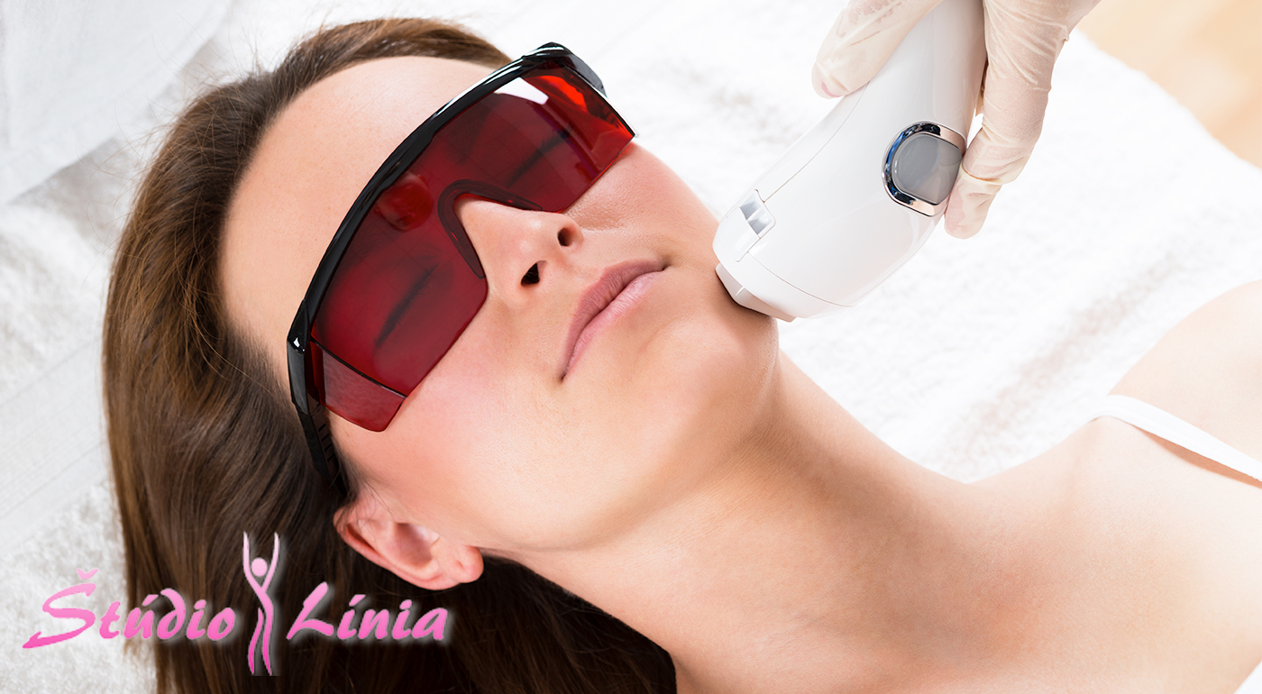 IPL epilácia pre pokožku bez chĺpkov