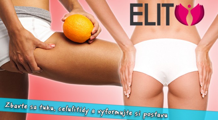 Rádiofrekvenčná liposukcia a presoterapia v Trnave. 