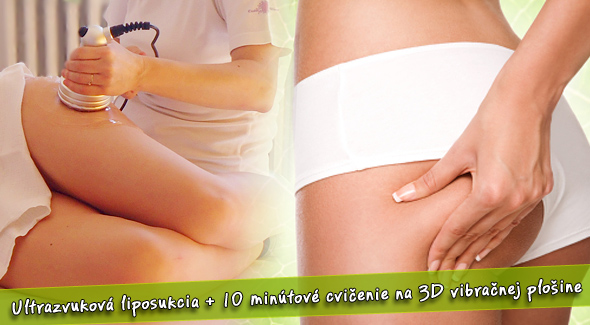 Centrum Ultrazvukovej Liposukcie - ultrazvuková liposukcia + 10 min. cvičenie na vibračnej plošine.